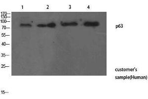 Western Blotting (WB) image for anti-T-Complex 1 (TCP1) (N-Term) antibody (ABIN3178214) (TCP1 alpha/CCTA antibody  (N-Term))