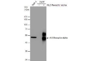 WB Image IL3 Receptor alpha antibody [N2C2], Internal detects IL3 Receptor alpha protein by western blot analysis. (IL3RA antibody)