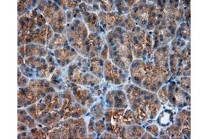 Immunohistochemical staining of paraffin-embedded liver tissue using anti-RC201933 mouse monoclonal antibody. (PIM2 antibody)