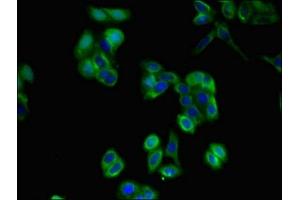 Immunofluorescent analysis of HepG2 cells using ABIN7163584 at dilution of 1:100 and Alexa Fluor 488-congugated AffiniPure Goat Anti-Rabbit IgG(H+L) (CD36 antibody  (AA 191-376))