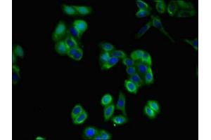 Immunofluorescent analysis of HepG2 cells using ABIN7163584 at dilution of 1:100 and Alexa Fluor 488-congugated AffiniPure Goat Anti-Rabbit IgG(H+L) (CD36 antibody  (AA 191-376))