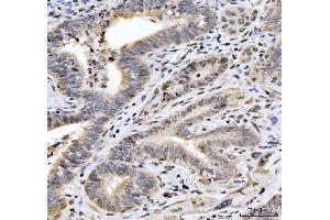 IHC analysis of HES5 using anti-HES5 antibody (ABIN7598966). (HES5 antibody  (AA 1-121))