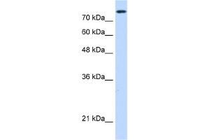 WB Suggested Anti-NCAPH Antibody Titration:  0. (NCAPH antibody  (C-Term))
