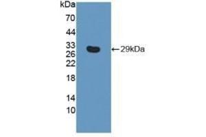 Detection of Recombinant ITGb6, Human using Polyclonal Antibody to Integrin Beta 6 (ITGb6)