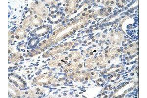 Image no. 1 for anti-Nucleus Accumbens Associated 1, BEN and BTB (POZ) Domain Containing (NACC1) (C-Term) antibody (ABIN202717) (NAC1 antibody  (C-Term))