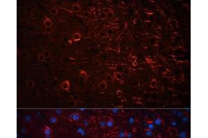 Immunofluorescence analysis of Mouse brain using Aquaporin 4 Polyclonal Antibody at dilution of 1:100 (40x lens). (Aquaporin 4 antibody)