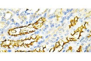 Immunohistochemistry of paraffin-embedded Mouse kidney using PPP2R4 Polyclonal Antibody at dilution of 1:200 (40x lens). (PPP2R4 antibody)