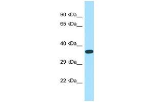 WB Suggested Anti-ASB14 Antibody Titration: 1. (ASB14 antibody  (N-Term))