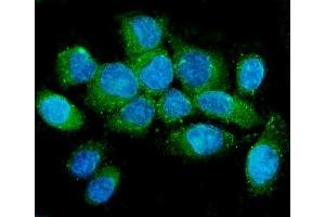 IF analysis of NMI using anti-NMI antibody (ABIN6719489). (NMI antibody  (AA 2-307))