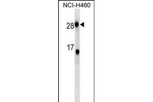 CRP Antibody (ABIN1539893 and ABIN2843851) western blot analysis in NCI- cell line lysates (35 μg/lane). (CRP antibody  (AA 8-35))