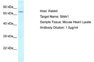 Host: Rabbit Target Name: Slitrk1 Sample Type: Mouse Heart lysates Antibody Dilution: 1. (SLITRK1 antibody  (C-Term))