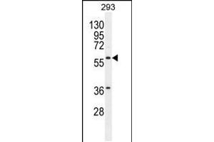Western blot analysis in 293 cell line lysates (35ug/lane). (Carboxypeptidase A2 antibody  (AA 179-208))