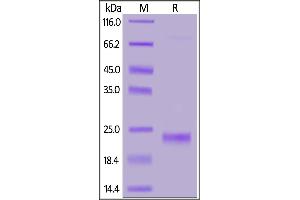 Human IL-17F, His Tag on  under reducing (R) condition. (IL17F Protein (AA 31-163) (His tag))