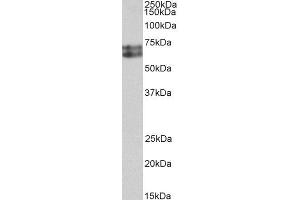 ABIN4902656 (0. (HDC antibody)