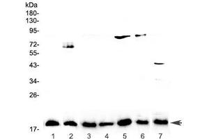 Western blot testing of 1) placenta, 2) PANC-1, 3) rat lymph, 4) rat small intestine, 5) rat testis, 6) rat ovary, and 7) mouse testis lysate with IL-23 antibody at 0.