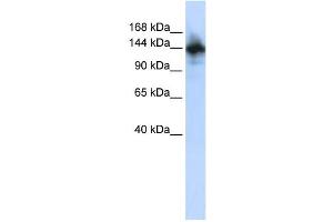 Western Blotting (WB) image for anti-RNA Binding Motif Protein 6 (RBM6) antibody (ABIN2457899)