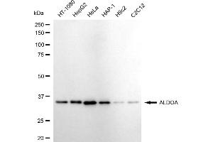 Western blotting analysis using ALDOA antibody (ABIN7797573).