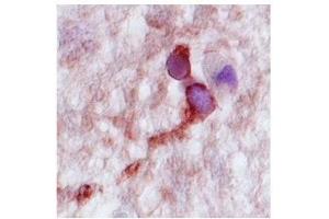 Complexin 2 in human hippocampus was delected using HRP/AEC red color stain. (CPLX2 antibody  (N-Term))