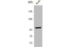 Western Blot analysis of HuvEc cells using NARG1 Polyclonal Antibody (NAA15 antibody  (Internal Region))
