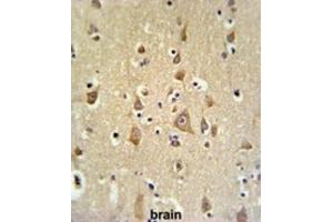 Immunohistochemistry (IHC) image for anti-Biorientation of Chromosomes in Cell Division 1 (BOD1) antibody (ABIN3004401)