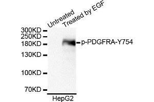 Western blot analysis of extracts of HepG2 cell line, using Phospho-PDGFRA-Y754 antibody. (PDGFRA antibody  (pTyr754))