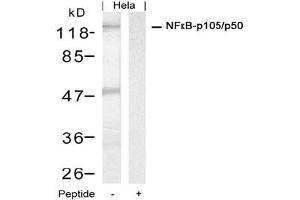 Image no. 1 for anti-Nuclear Factor of kappa Light Polypeptide Gene Enhancer in B-Cells 1 (NFKB1) (Ser927) antibody (ABIN319348) (NFKB1 antibody  (Ser927))