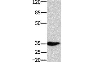 Western blot analysis of Mouse muscle tissue, using HOXA11 Polyclonal Antibody at dilution of 1:350 (Homeobox A11 antibody)