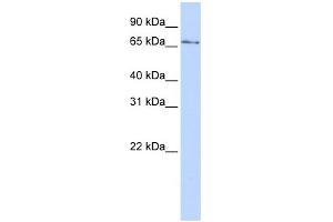 WB Suggested Anti-KLHL26 Antibody Titration:  0.