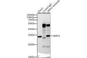 Immunoprecipitation analysis of 300 μg extracts of HepG2 cells using 3 μg  antibody (ABIN7265385). (ARPC2 antibody)