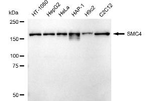 Western blotting analysis using SMC4 antibody (ABIN7800449). (Recombinant SMC4 antibody)
