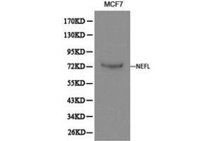 Western Blotting (WB) image for anti-Neurofilament, Light Polypeptide (NEFL) antibody (ABIN1873871) (NEFL antibody)