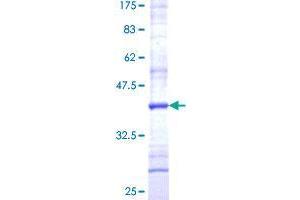SPCS3 Protein (AA 32-141) (GST tag)