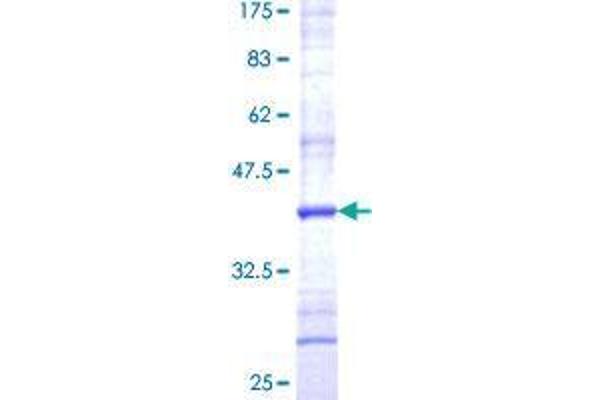 SPCS3 Protein (AA 32-141) (GST tag)