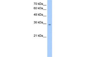 WB Suggested Anti-MDH2 Antibody Titration:  2. (MDH2 antibody  (C-Term))