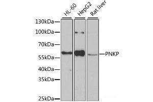 Western blot analysis of extracts of various cell lines using PNKP Polyclonal Antibody at dilution of 1:1000.