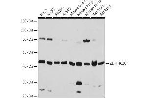 Western blot analysis of extracts of various cell lines, using ZDHHC20 antibody (ABIN7271551) at 1:1000 dilution. (ZDHHC20 antibody)