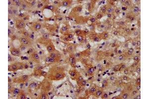 IHC image of ABIN7170786 diluted at 1:400 and staining in paraffin-embedded human liver tissue performed on a Leica BondTM system. (NSDHL antibody  (AA 154-211))