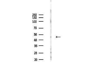 anti-Acyl-CoA Dehydrogenase, Long Chain (ACADL) (Internal Region) antibody
