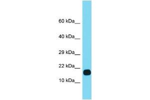 Host: Rabbit Target Name: FUOM Sample Type: Fetal Heart lysates Antibody Dilution: 1. (FUOM antibody  (Middle Region))