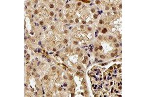 Immunohistochemical analysis of GGA2 staining in human kidney formalin fixed paraffin embedded tissue section. (GGA2 antibody)