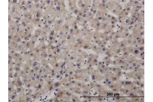 Immunoperoxidase of polyclonal antibody to NIPSNAP3A on formalin-fixed paraffin-embedded human liver.