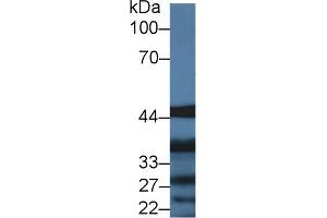 Western blot analysis of Pig Liver lysate, using Human IL13Ra1 Antibody (2 µg/ml) and HRP-conjugated Goat Anti-Rabbit antibody (