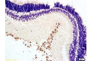 Formalin-fixed and paraffin embedded rat retina labeled with Anti-MTNR1B Polyclonal Antibody, Unconjugated (ABIN730318) at 1:200 followed by conjugation to the secondary antibody and DAB staining. (Melatonin Receptor 1B antibody  (AA 201-300))