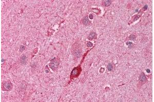 Human Brain, Cortex (formalin-fixed, paraffin-embedded) stained with HMOX2 antibody ABIN214113 at 5 ug/ml followed by biotinylated goat anti-rabbit IgG secondary antibody ABIN481713, alkaline phosphatase-streptavidin and chromogen. (HMOX2 antibody  (N-Term))
