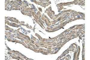 Asporin antibody was used for immunohistochemistry at a concentration of 4-8 ug/ml to stain Skeletal muscle cells (arrows) in Human Muscle. (Asporin antibody  (Middle Region))
