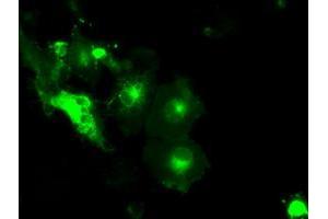 Image no. 5 for anti-Solute Carrier Family 2 (Facilitated Glucose/fructose Transporter), Member 5 (SLC2A5) antibody (ABIN1498472) (SLC2A5 antibody)