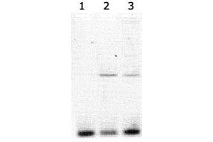 Lanes 1-3 contained Clock polyclonal antibody  immunoprecipitated DNA (15, 10 and 5 uL of antisera added respectively to the 900 uL of sonicated chromatin sample in the ChIP assay). (CLOCK antibody)