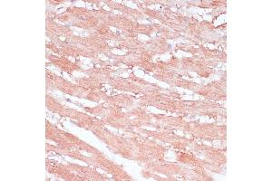 Immunohistochemistry of paraffin-embedded rat heart using RPL30 antibody (ABIN6130903, ABIN6147135, ABIN6147136 and ABIN6217777) at dilution of 1:100 (40x lens). (RPL30 antibody  (AA 1-115))