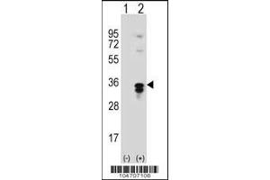 Western blot analysis of PPT1 using rabbit polyclonal PPT1 Antibody (A284) using 293 cell lysates (2 ug/lane) either nontransfected (Lane 1) or transiently transfected (Lane 2) with the PPT1 gene.