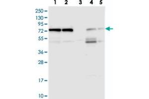 Western blot analysis of Lane 1: RT-4, Lane 2: U-251 MG, Lane 3: Human Plasma, Lane 4: Liver, Lane 5: Tonsil with KARS polyclonal antibody  at 1:250-1:500 dilution.